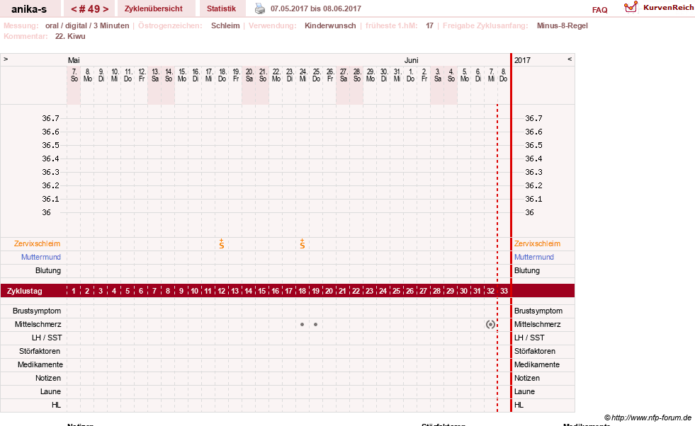 NFP-Kurve User #21449