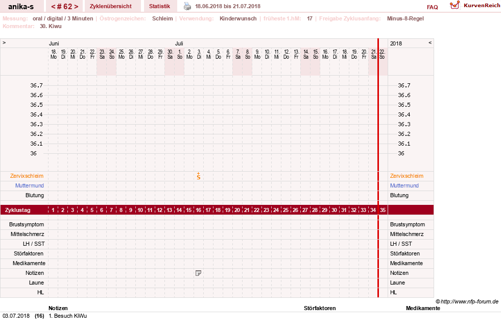 NFP-Kurve User #21449