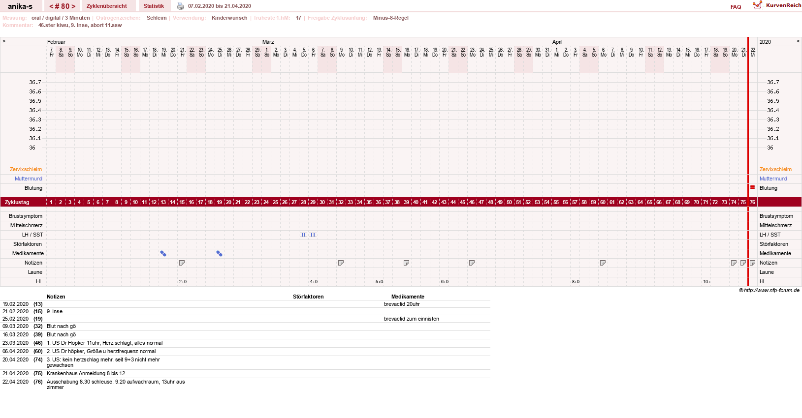NFP-Kurve User #21449