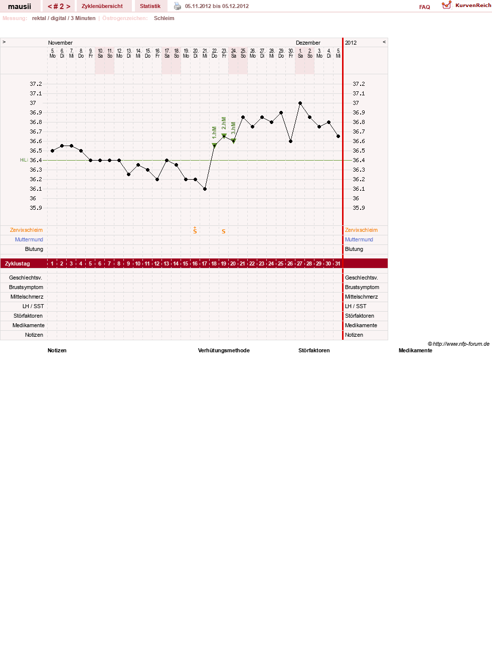 NFP-Kurve User #21513