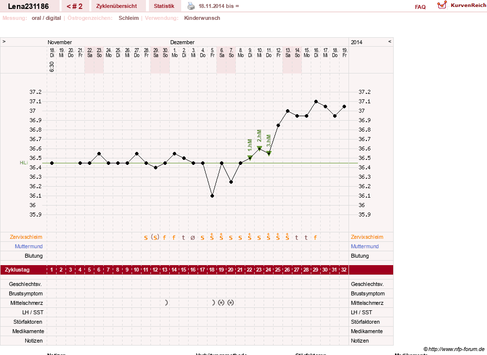 NFP-Kurve User #21704