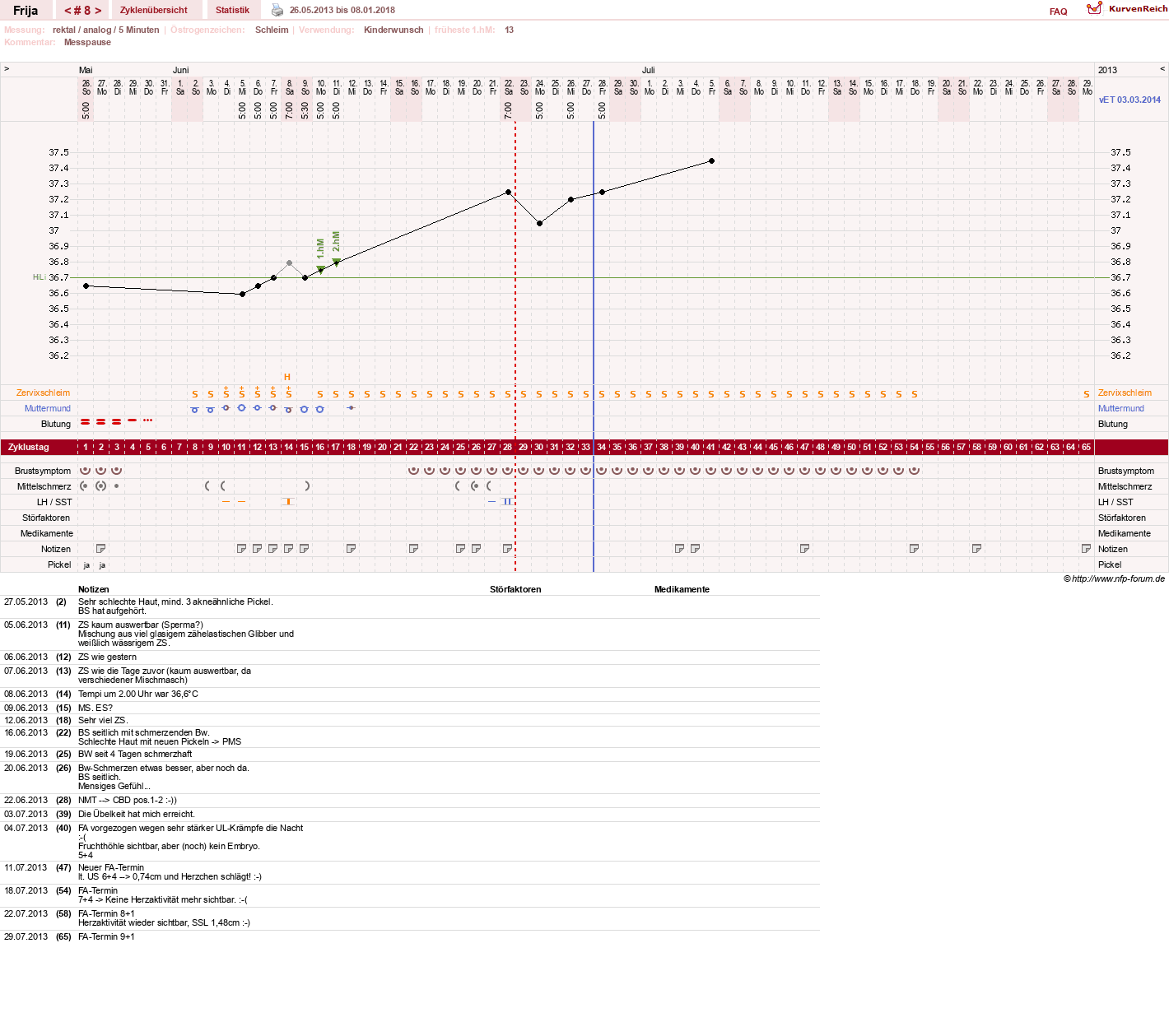 NFP-Kurve User #21801