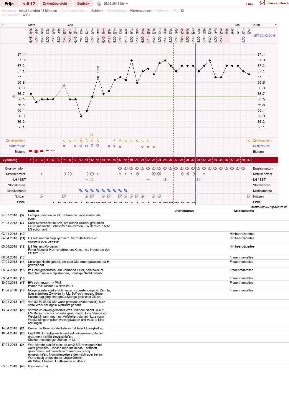 NFP-Kurve User #21801