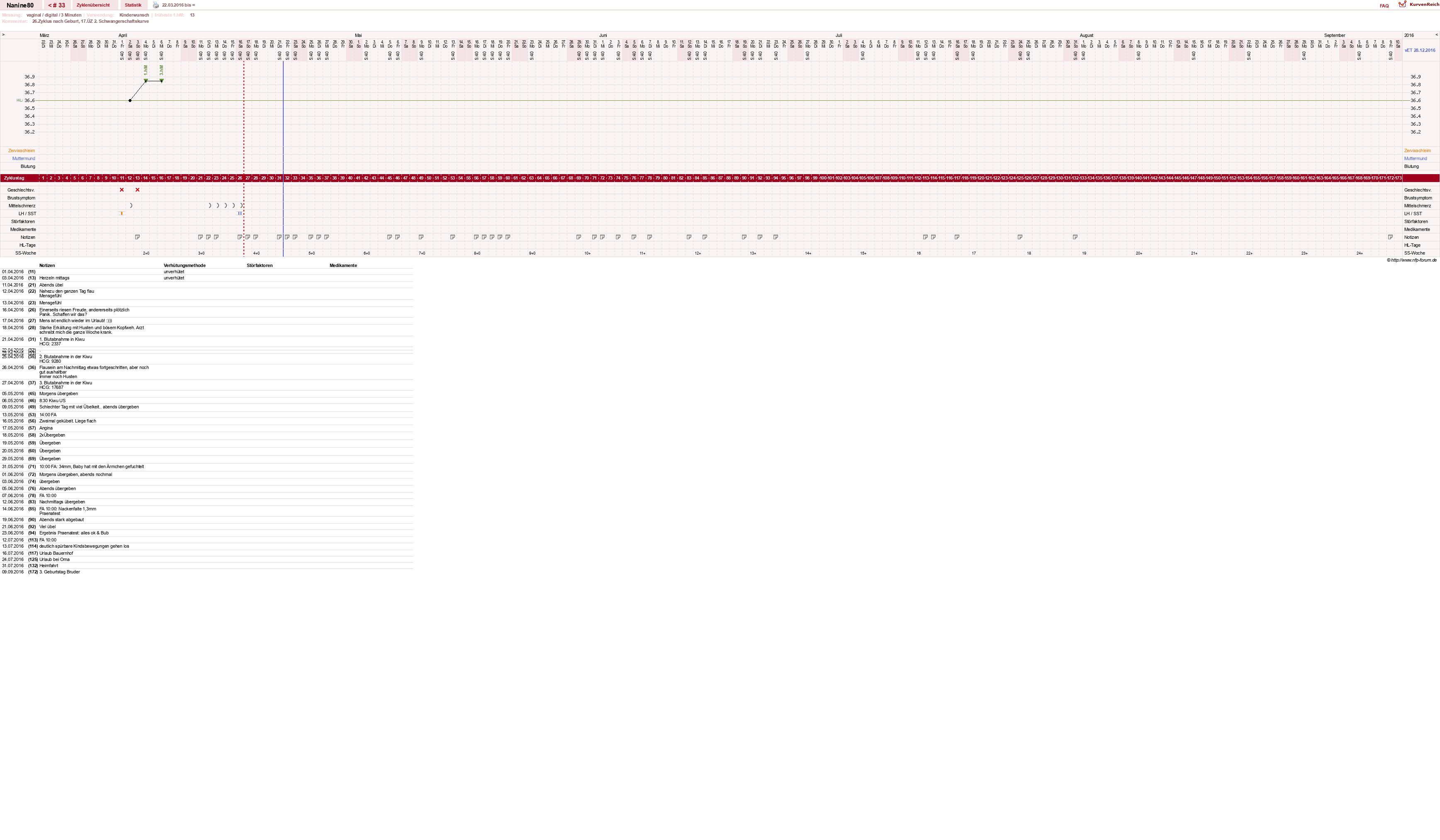 NFP-Kurve User #21805