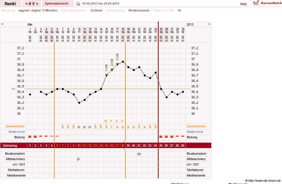 NFP-Kurve User #22308