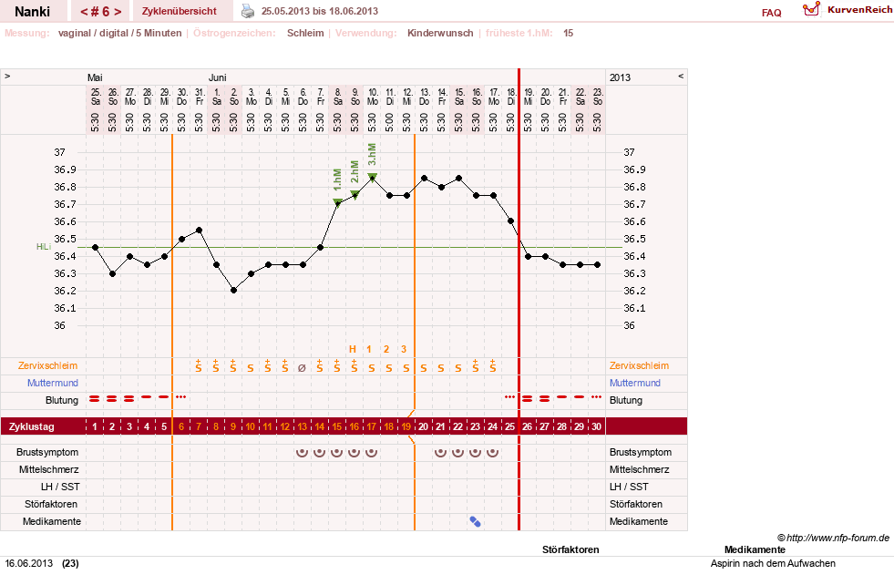 NFP-Kurve User #22308