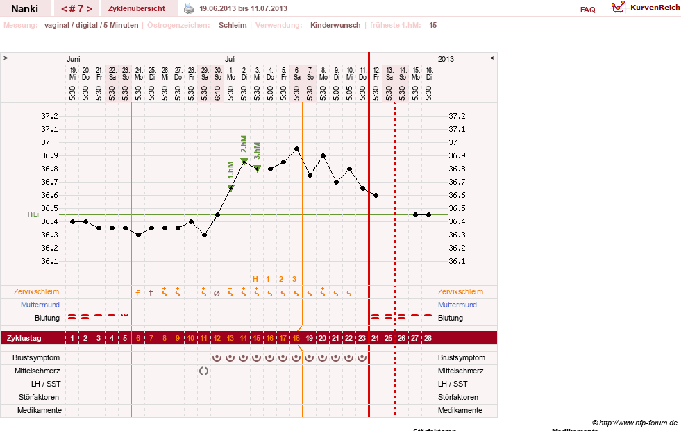 NFP-Kurve User #22308