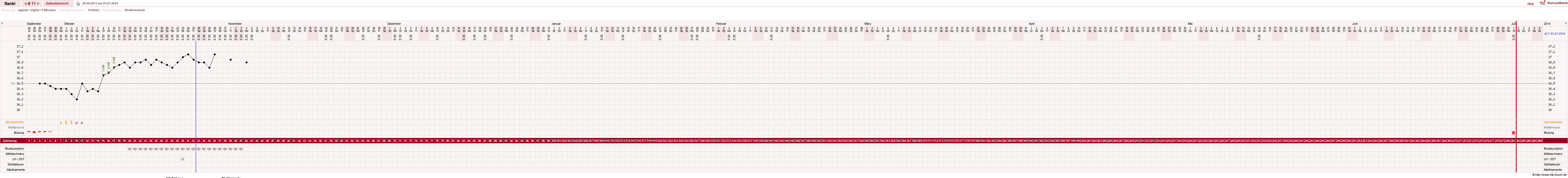 NFP-Kurve User #22308