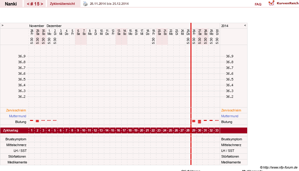 NFP-Kurve User #22308