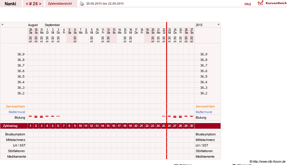 NFP-Kurve User #22308