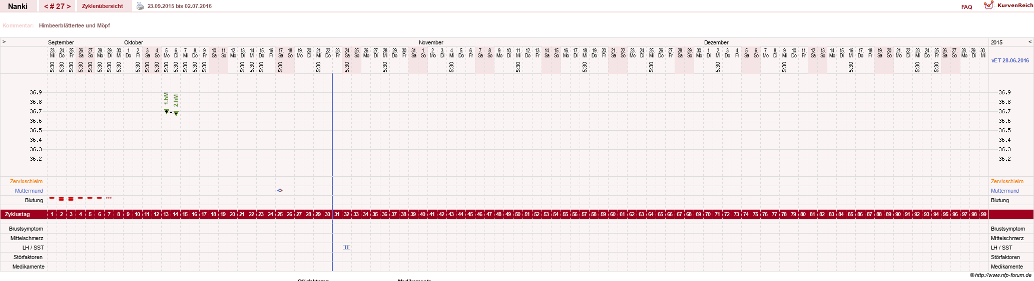 NFP-Kurve User #22308