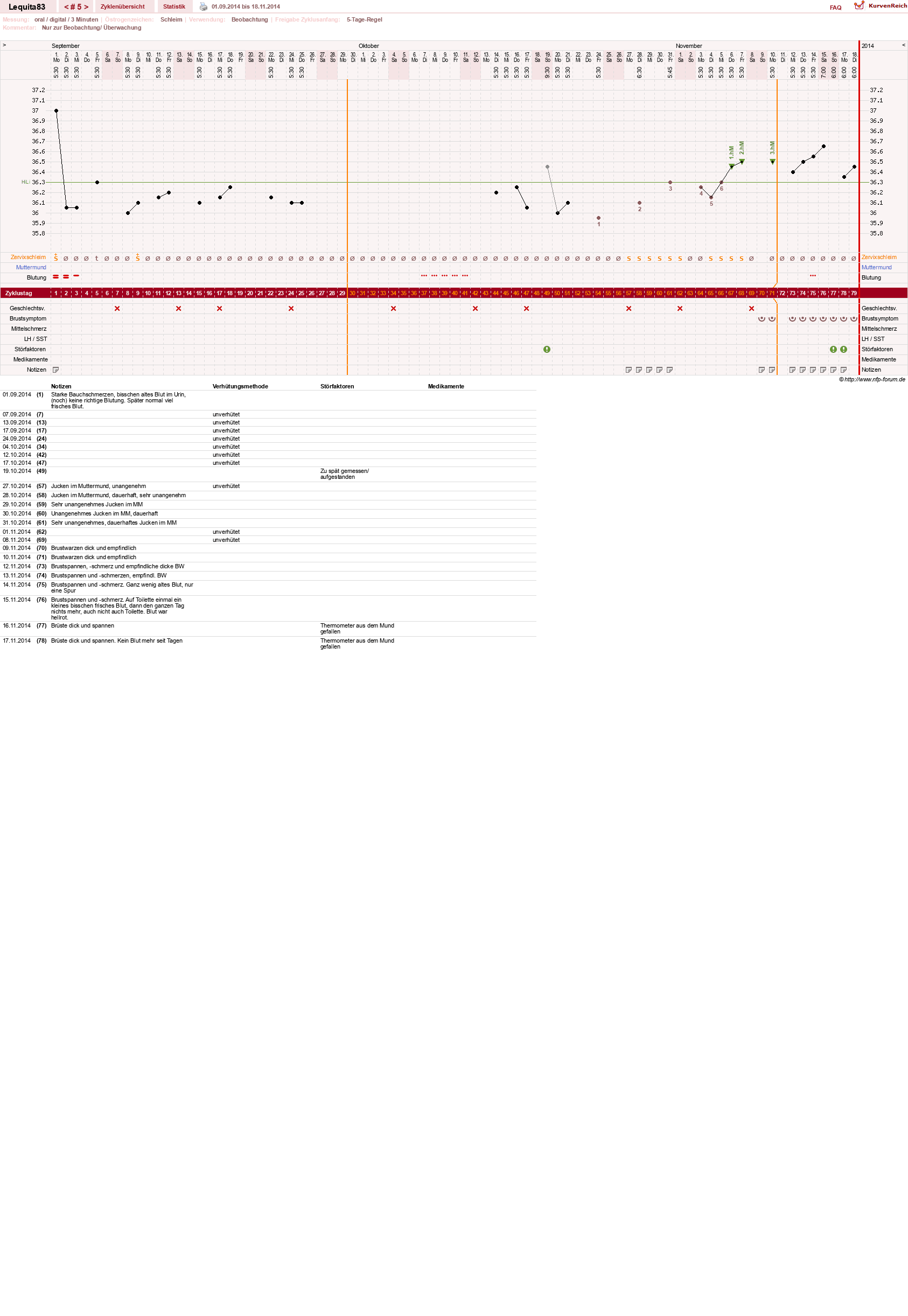 NFP-Kurve User #22461