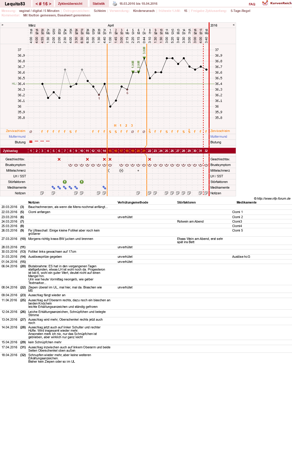NFP-Kurve User #22461
