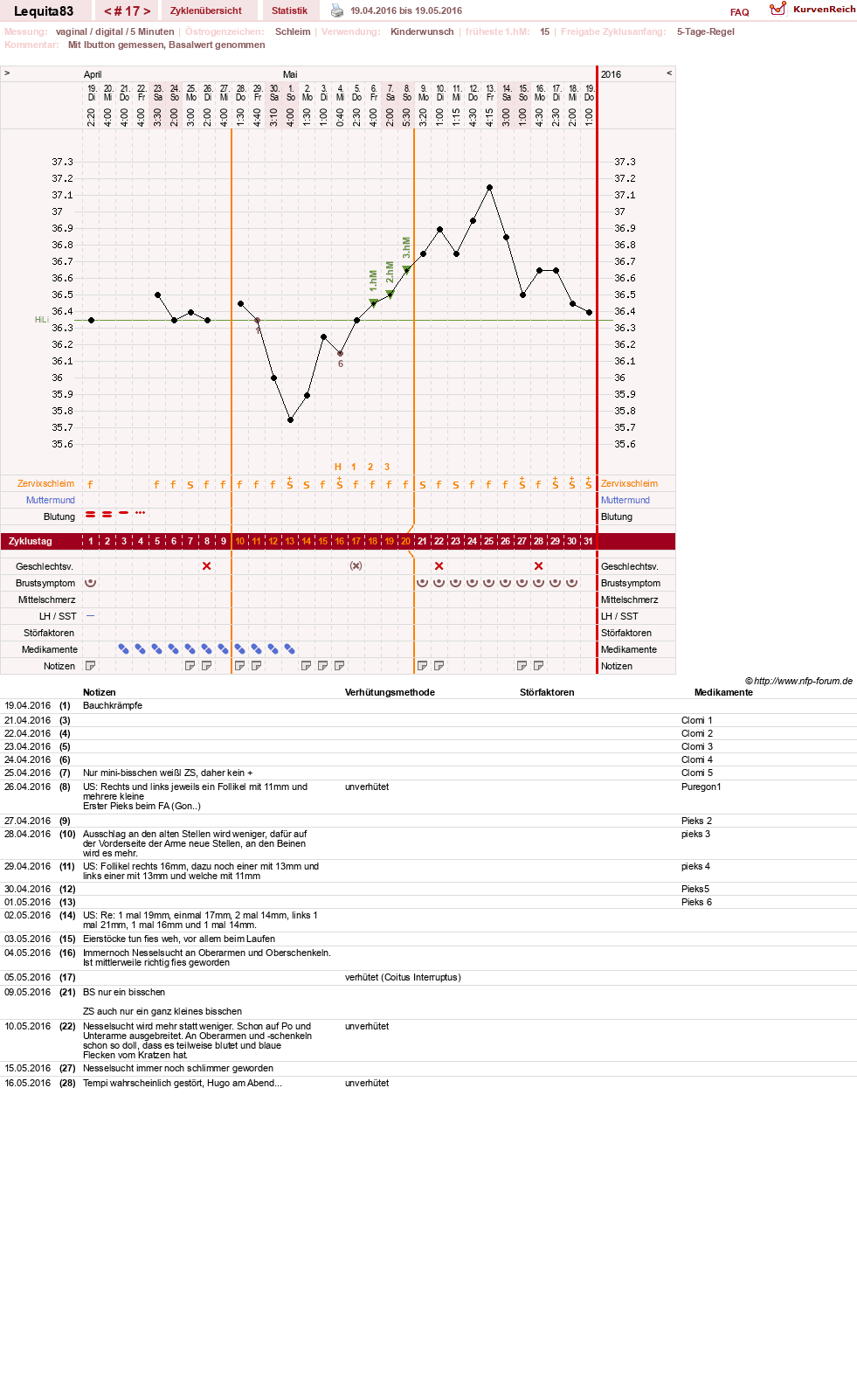 NFP-Kurve User #22461