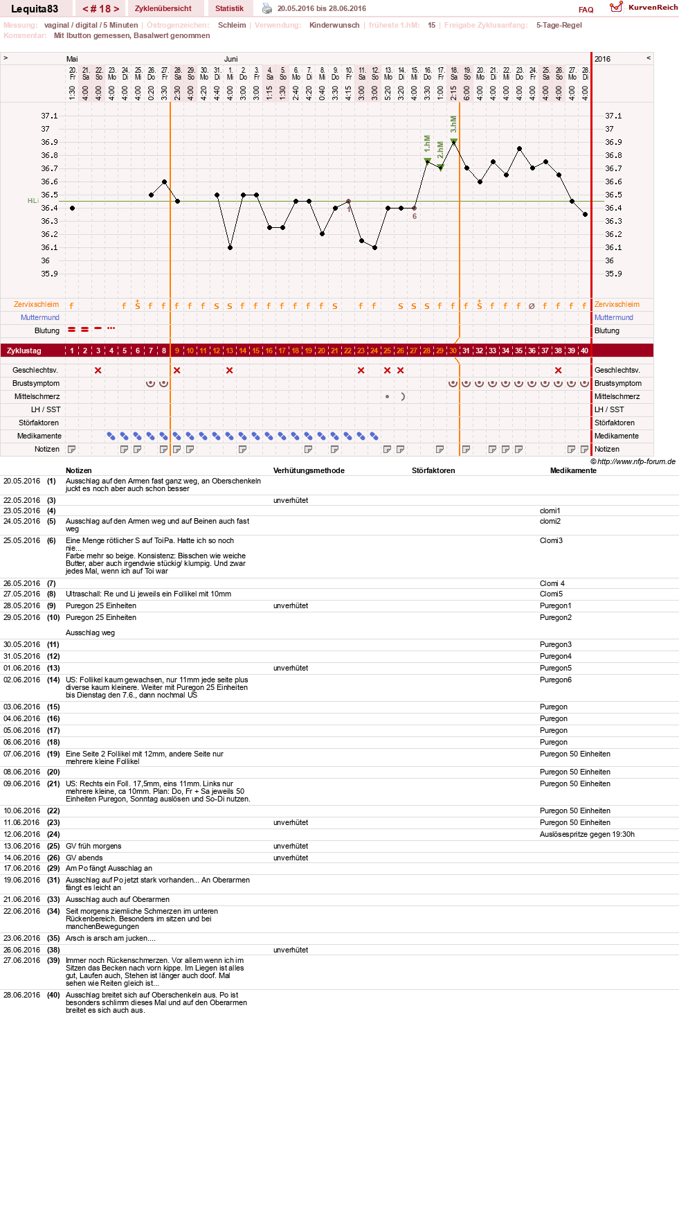 NFP-Kurve User #22461