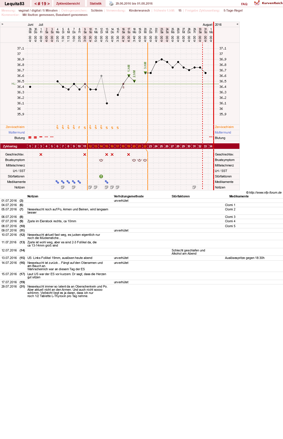 NFP-Kurve User #22461