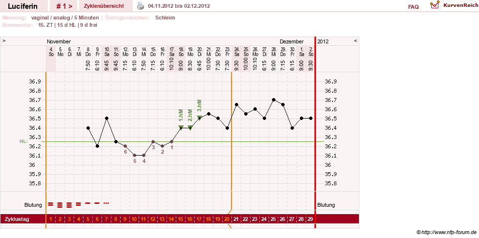NFP-Kurve User #22549