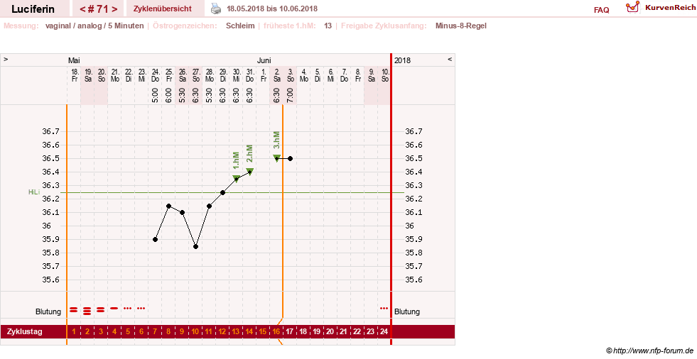 NFP-Kurve User #22549