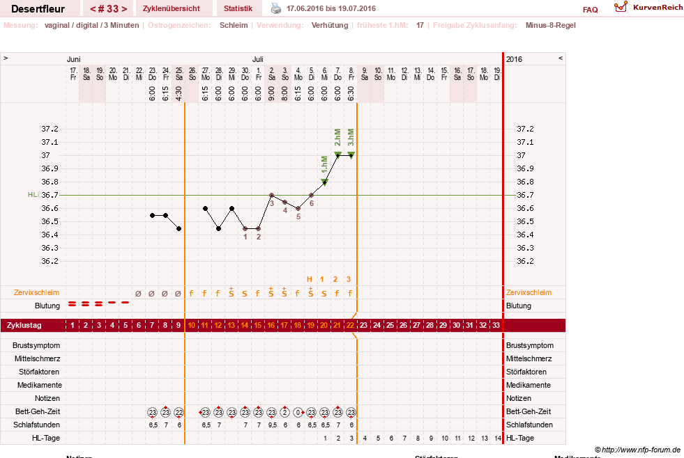 NFP-Kurve User #23276