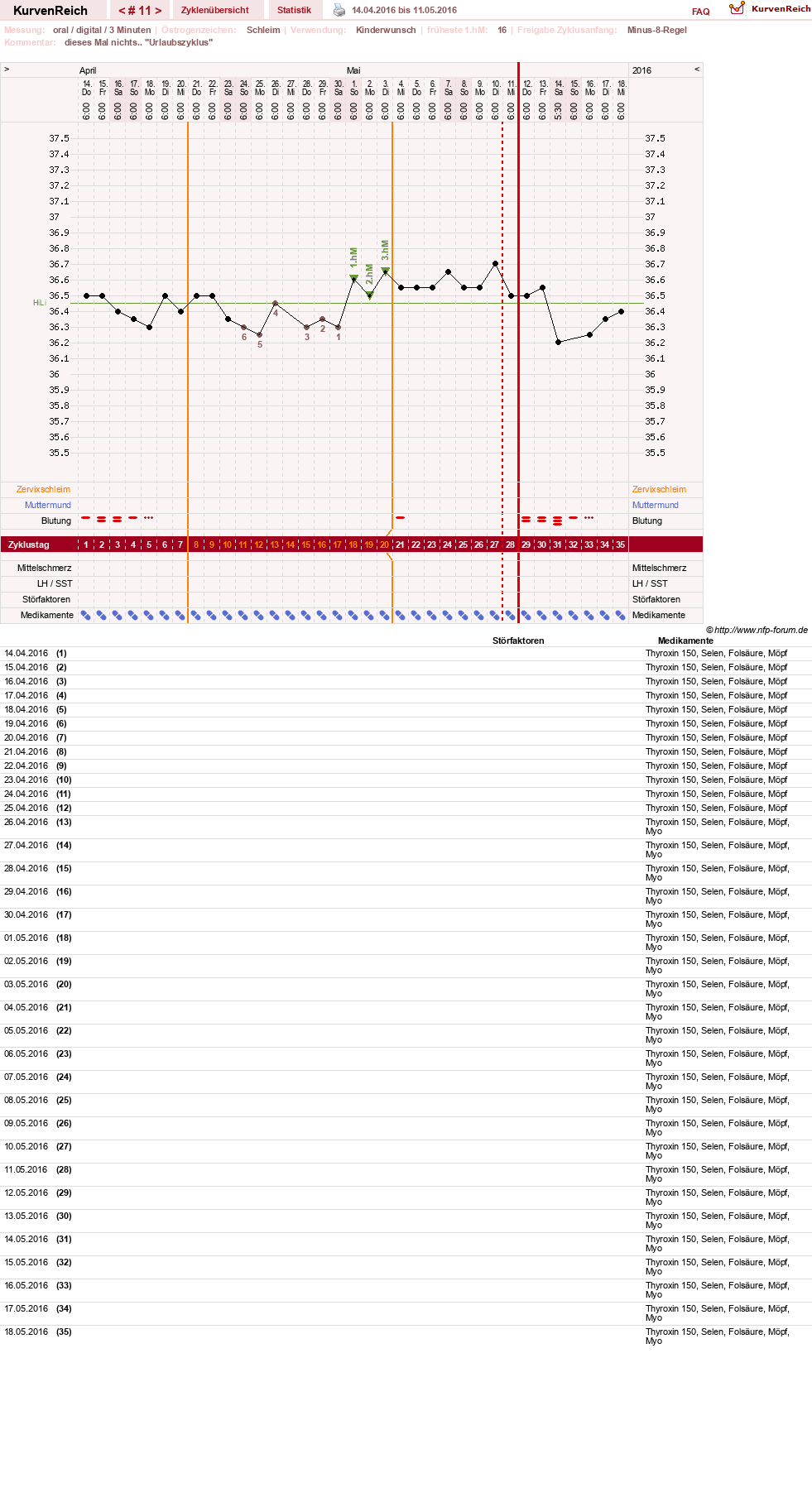 NFP-Kurve User #23331