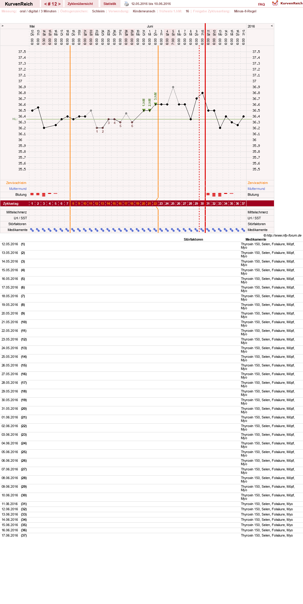 NFP-Kurve User #23331