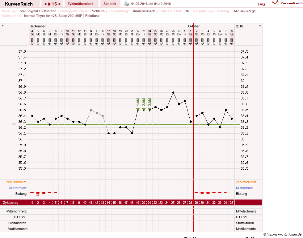 NFP-Kurve User #23331