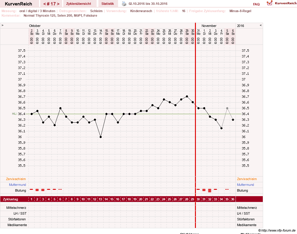 NFP-Kurve User #23331