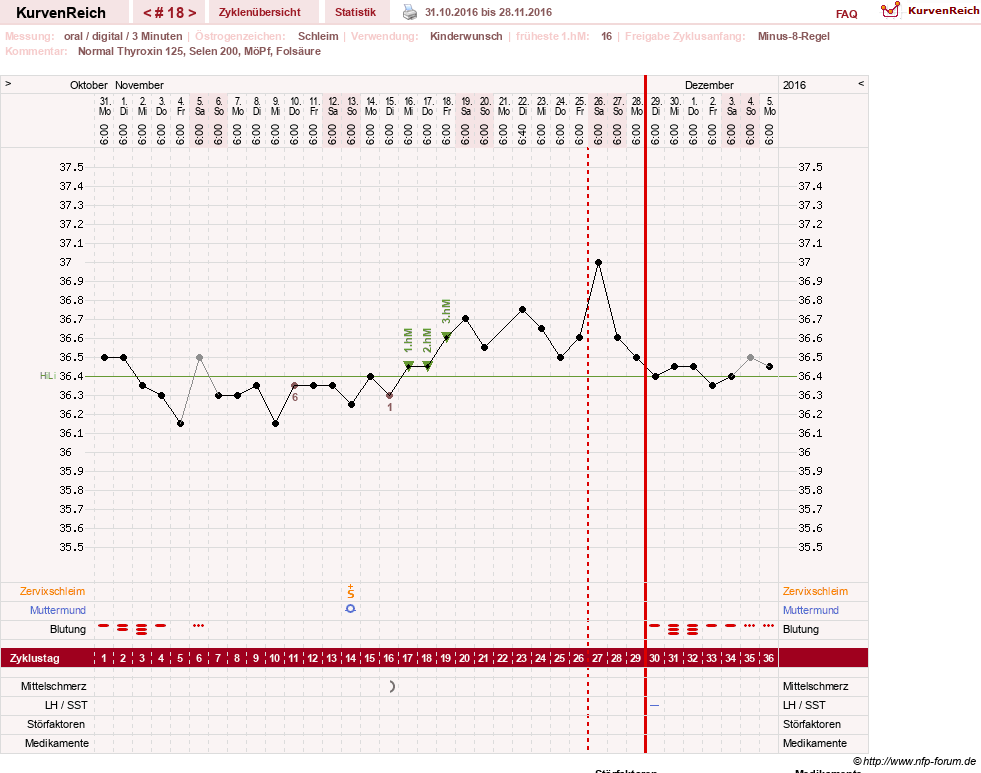 NFP-Kurve User #23331