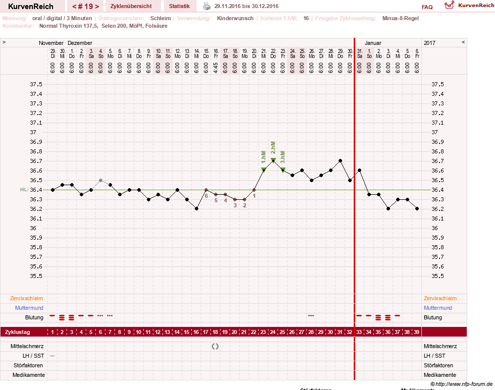NFP-Kurve User #23331