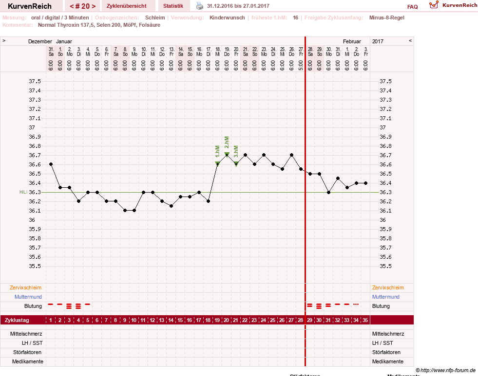 NFP-Kurve User #23331