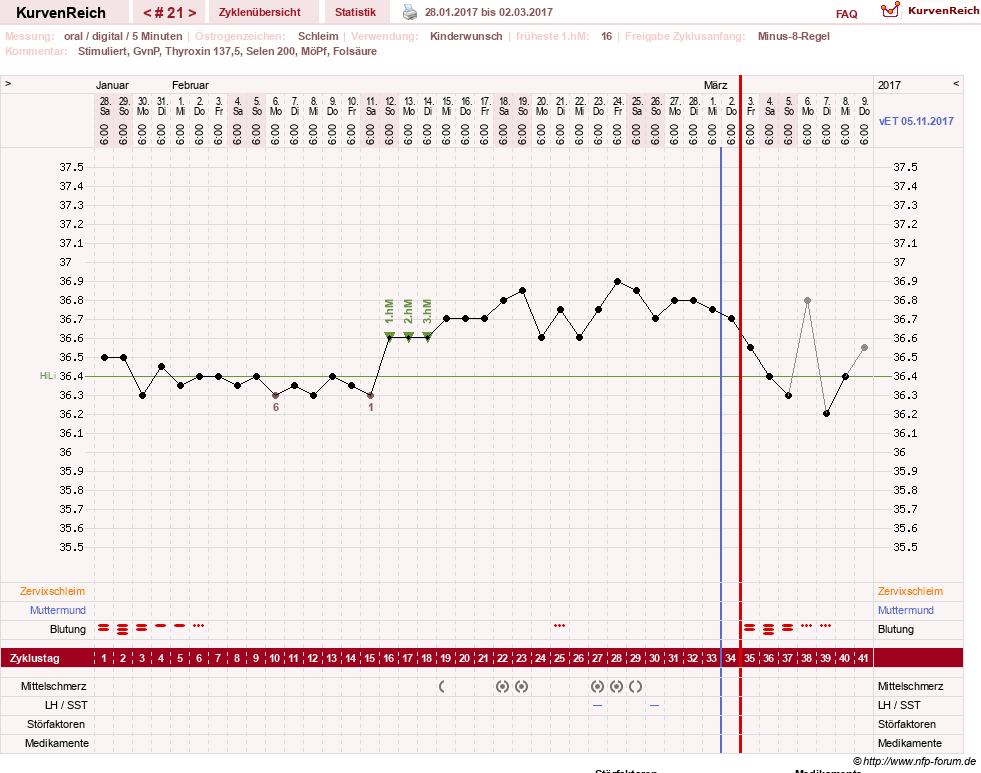 NFP-Kurve User #23331