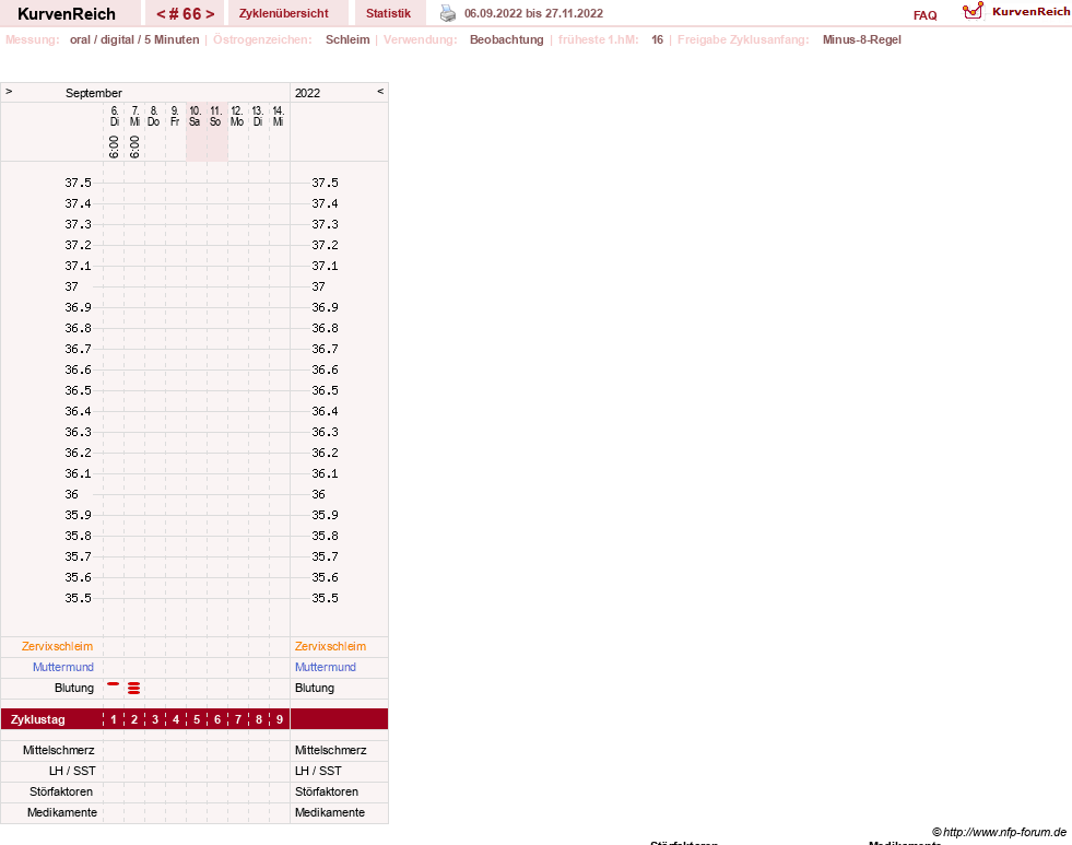 NFP-Kurve User #23331