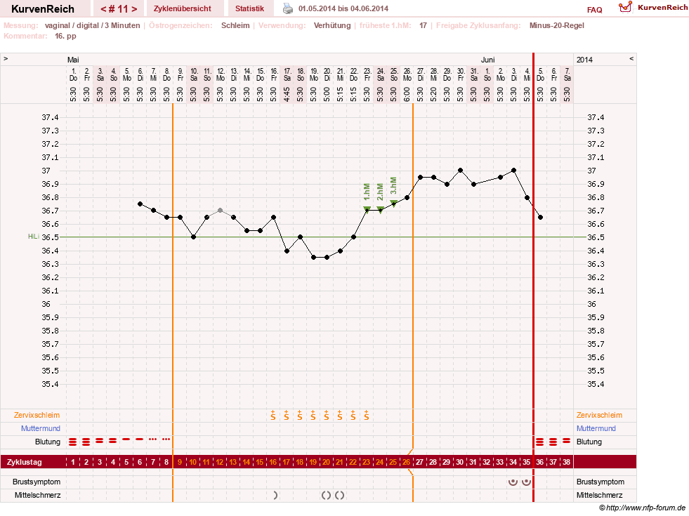 NFP-Kurve User #23416