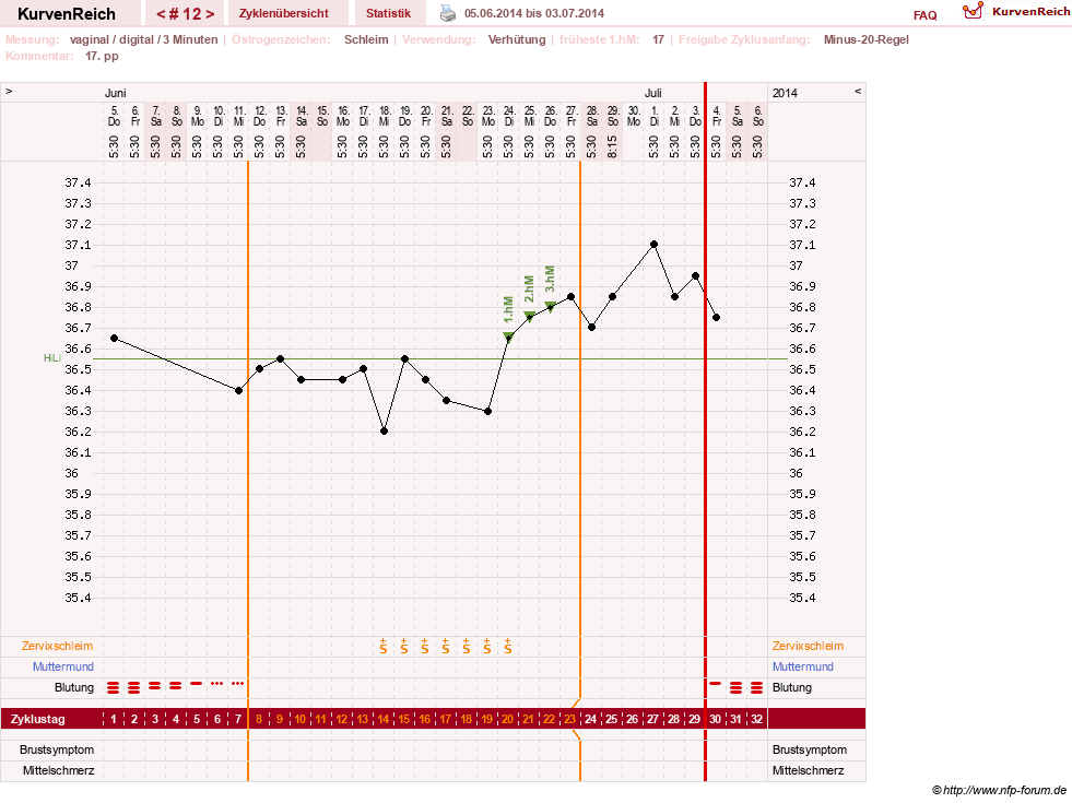 NFP-Kurve User #23416