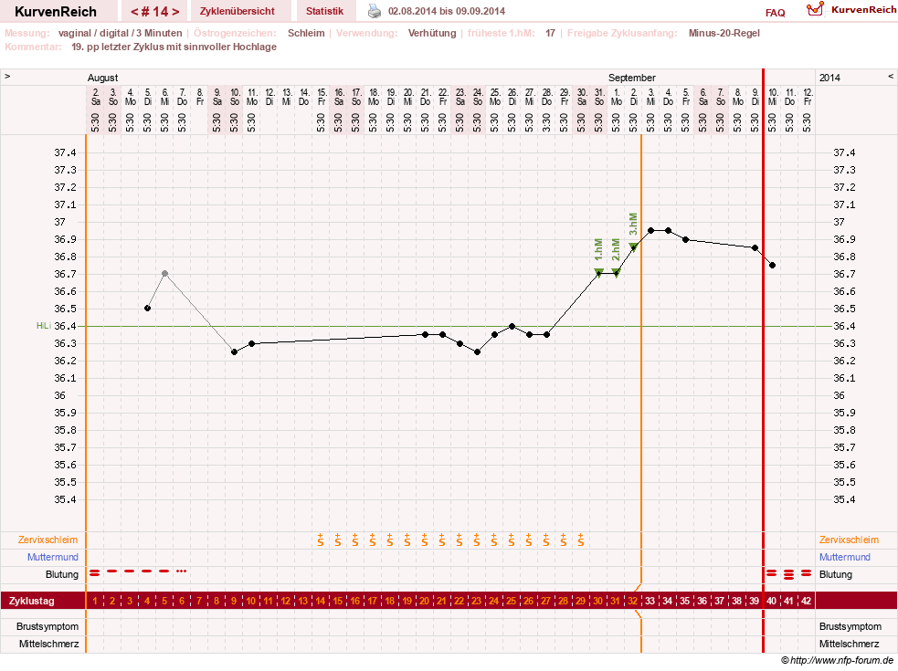 NFP-Kurve User #23416
