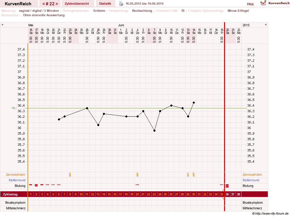 NFP-Kurve User #23416