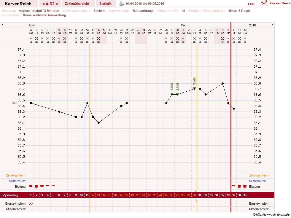 NFP-Kurve User #23416
