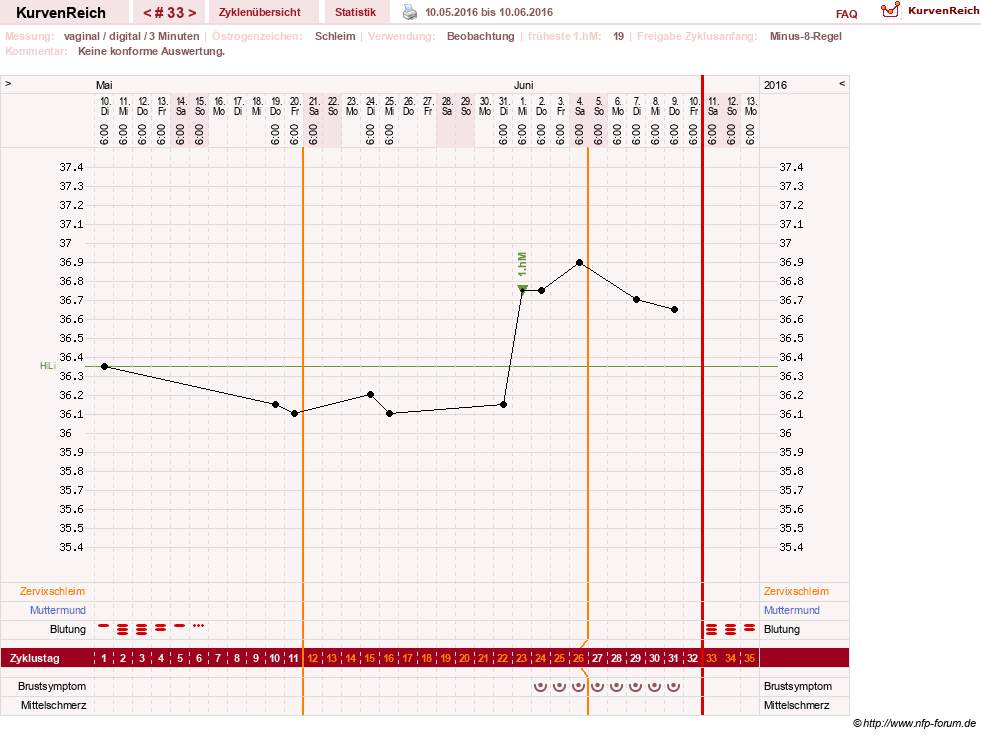 NFP-Kurve User #23416