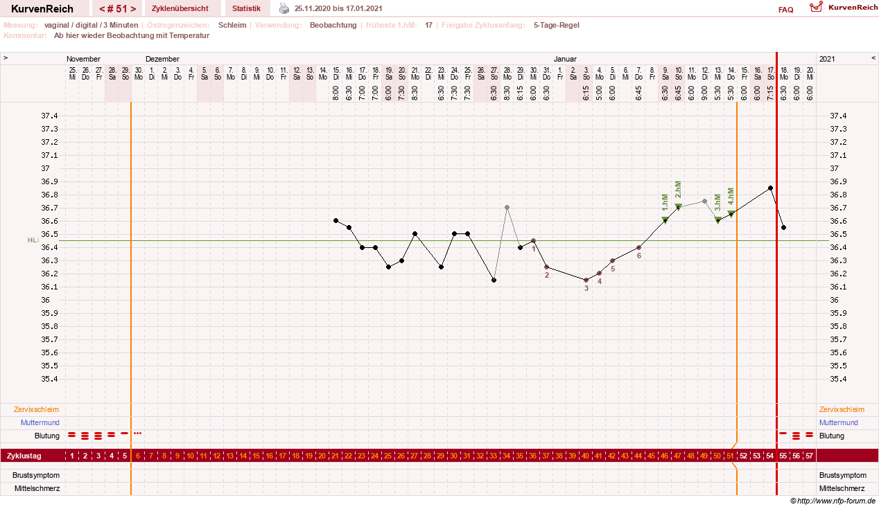 NFP-Kurve User #23416