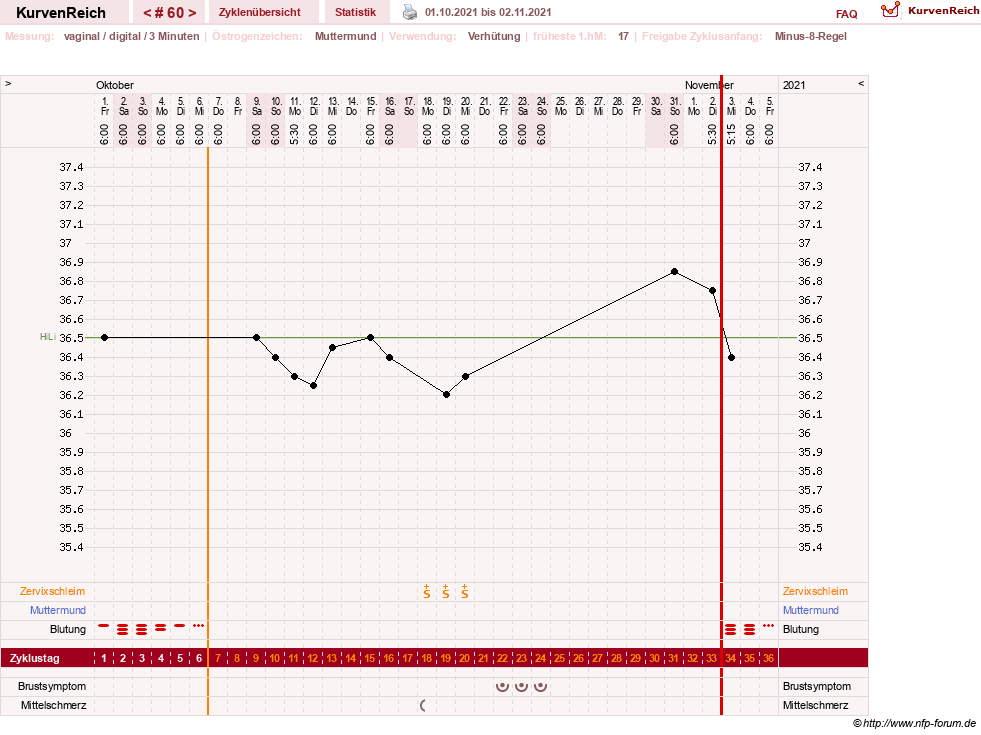 NFP-Kurve User #23416