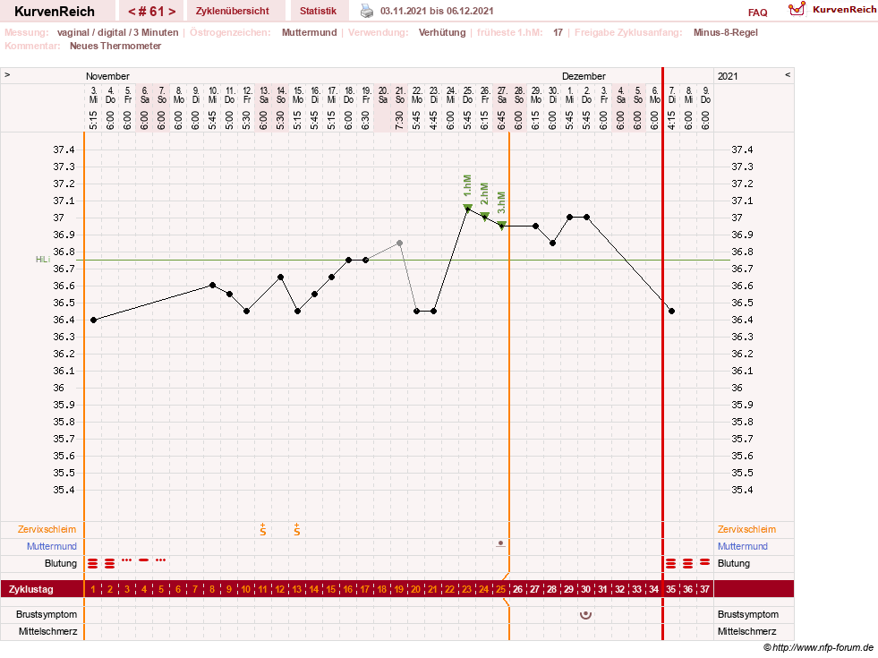 NFP-Kurve User #23416