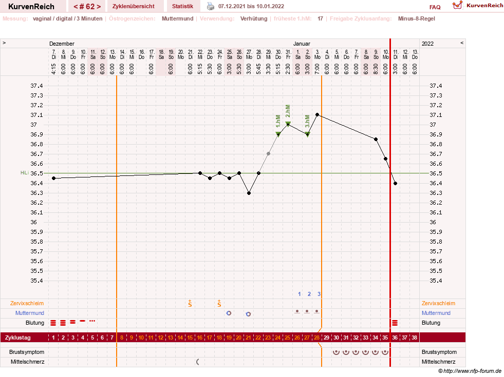 NFP-Kurve User #23416