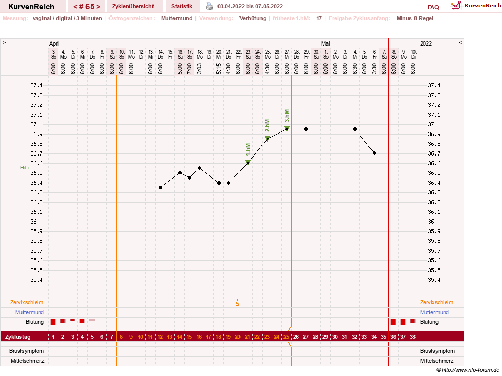 NFP-Kurve User #23416