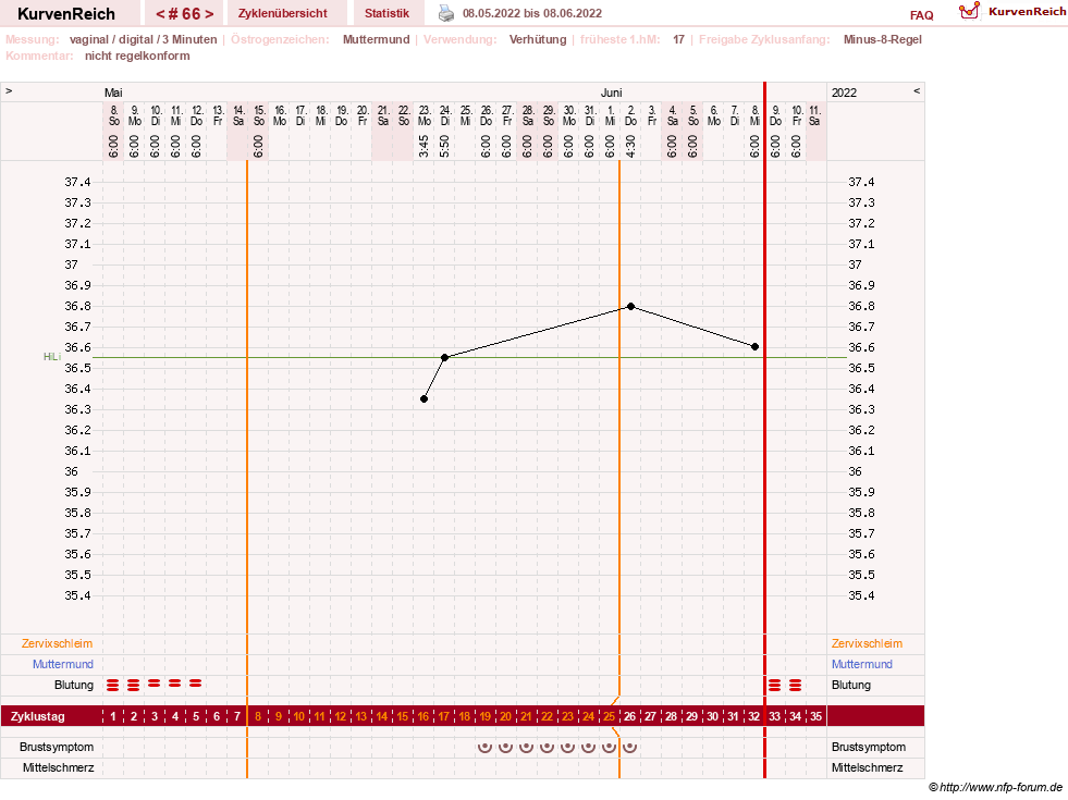 NFP-Kurve User #23416