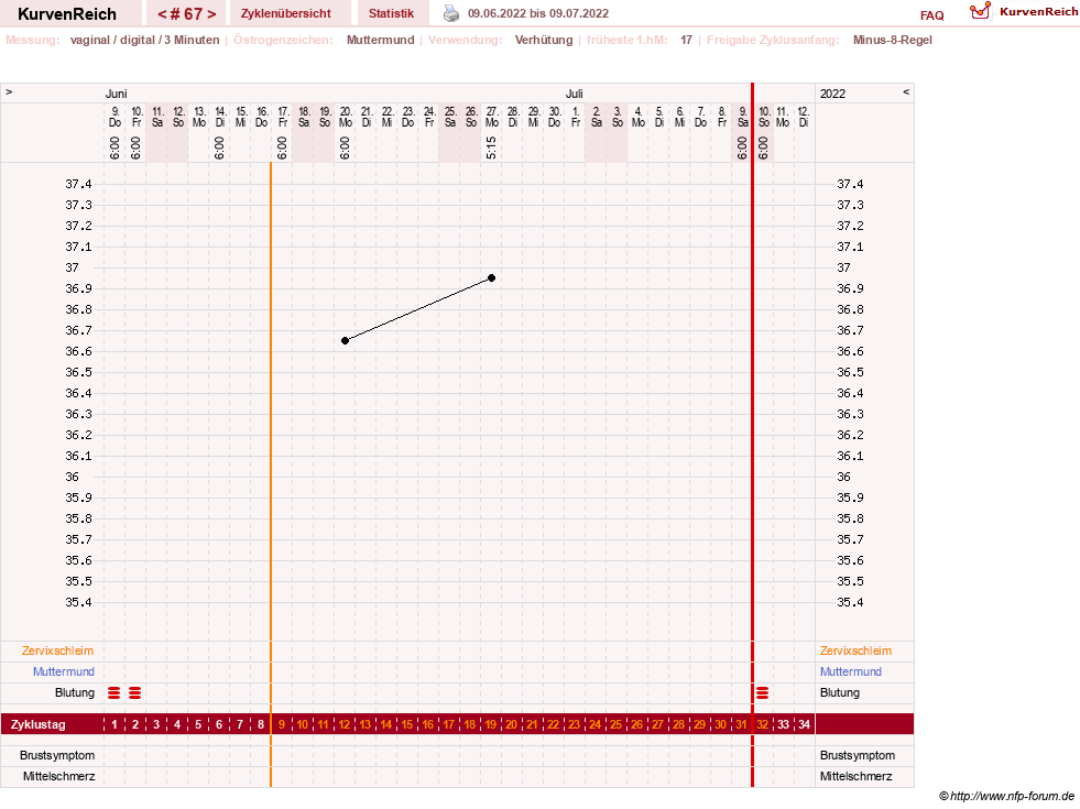 NFP-Kurve User #23416