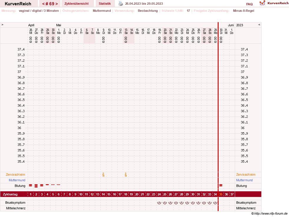 NFP-Kurve User #23416