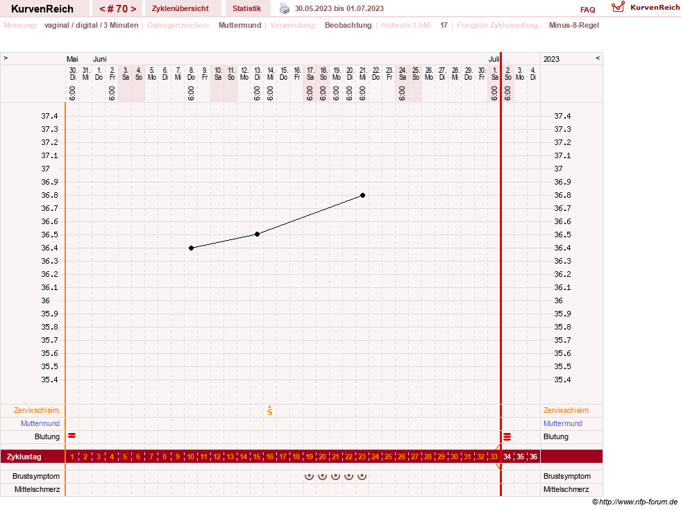 NFP-Kurve User #23416