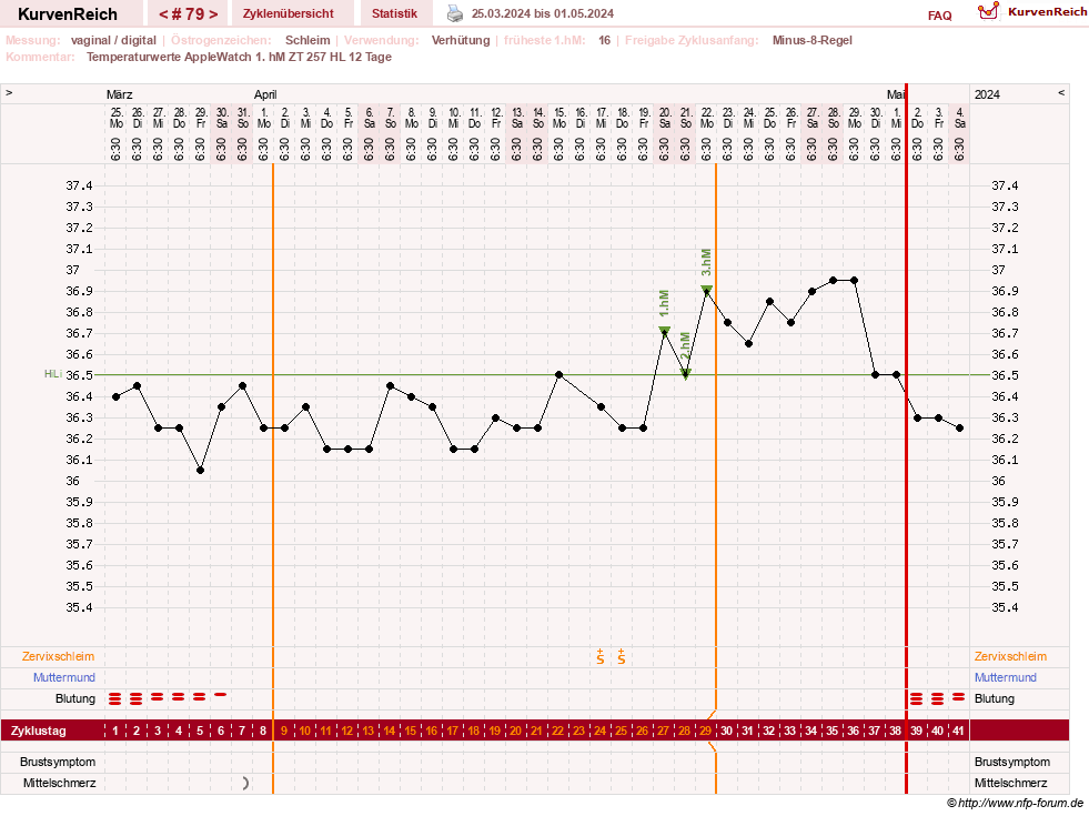 NFP-Kurve User #23416
