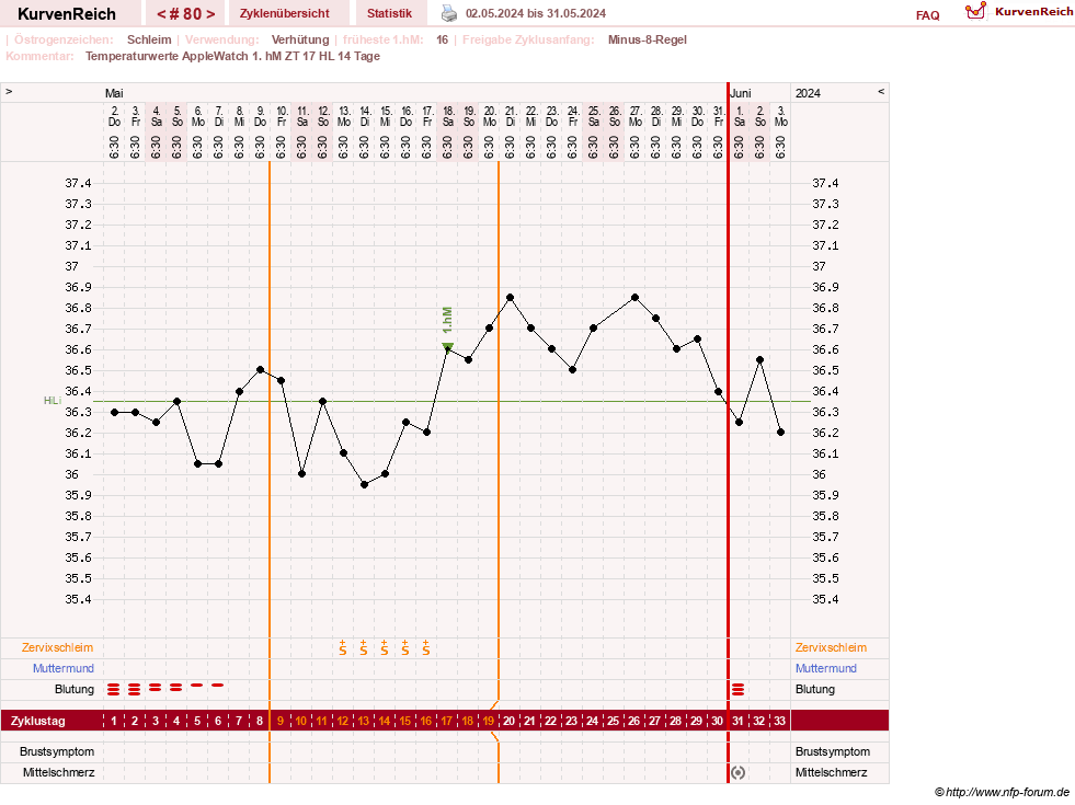 NFP-Kurve User #23416