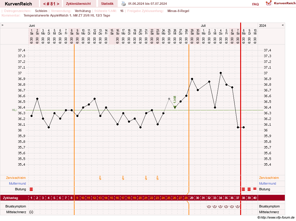 NFP-Kurve User #23416
